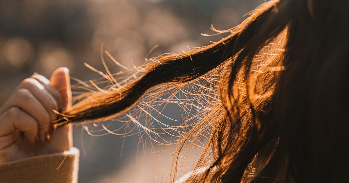 Methyltestosterone and Hair: The Risk of Androgenic Balding